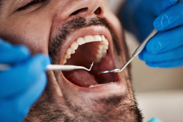 Best Walk-In Emergency Dentist in Superior, NE
